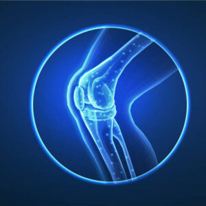 Orthopedic